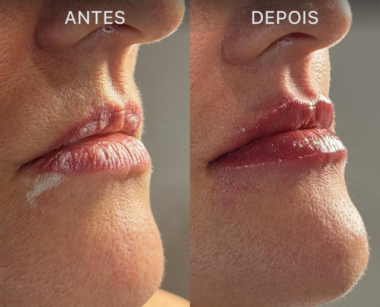 Antes e Depois Dra Lívia 11