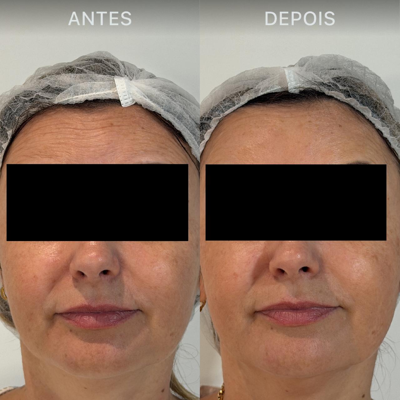 Antes e Depois Dra Lívia 15