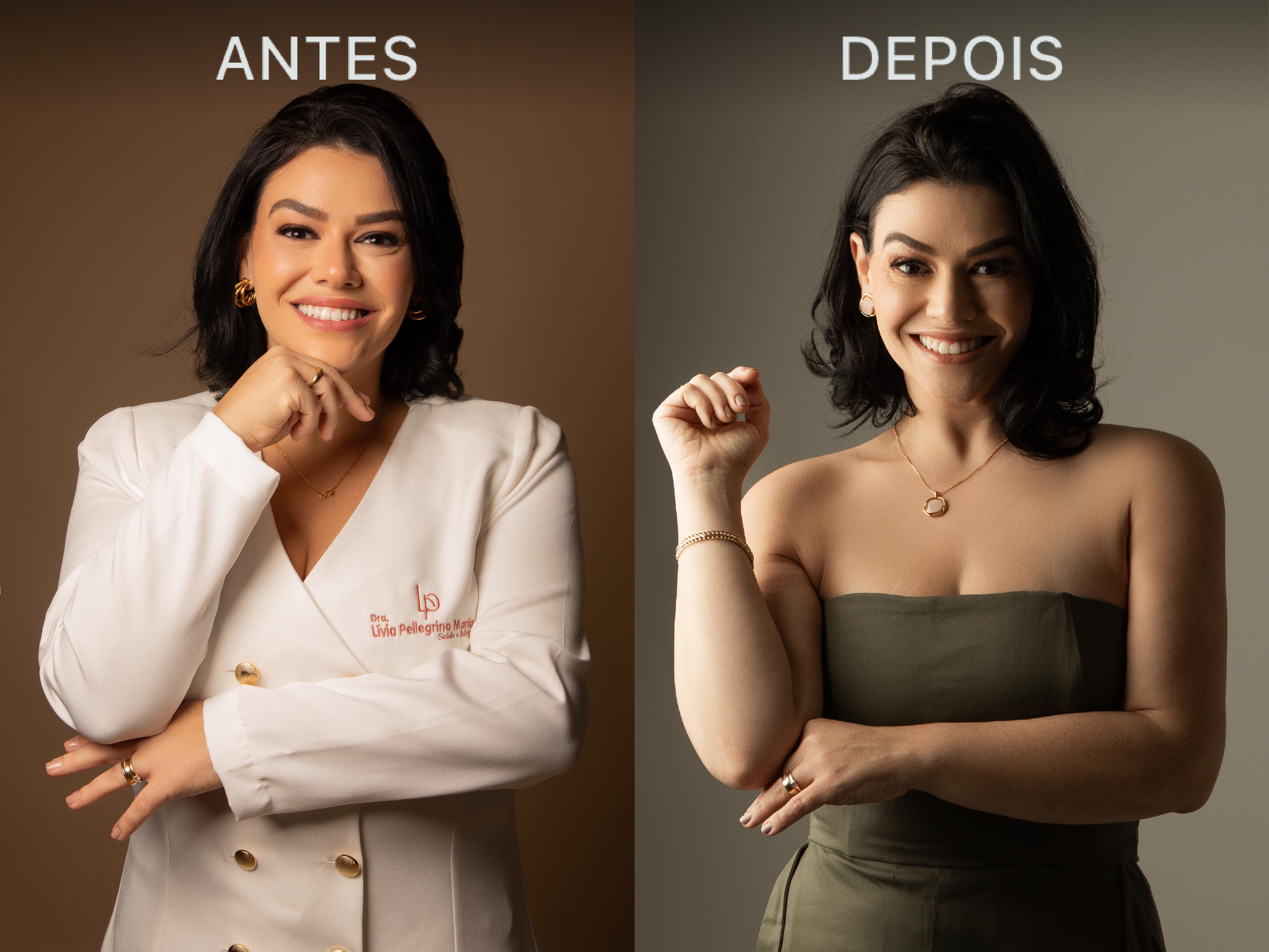 Antes e Depois Dra Lívia 18