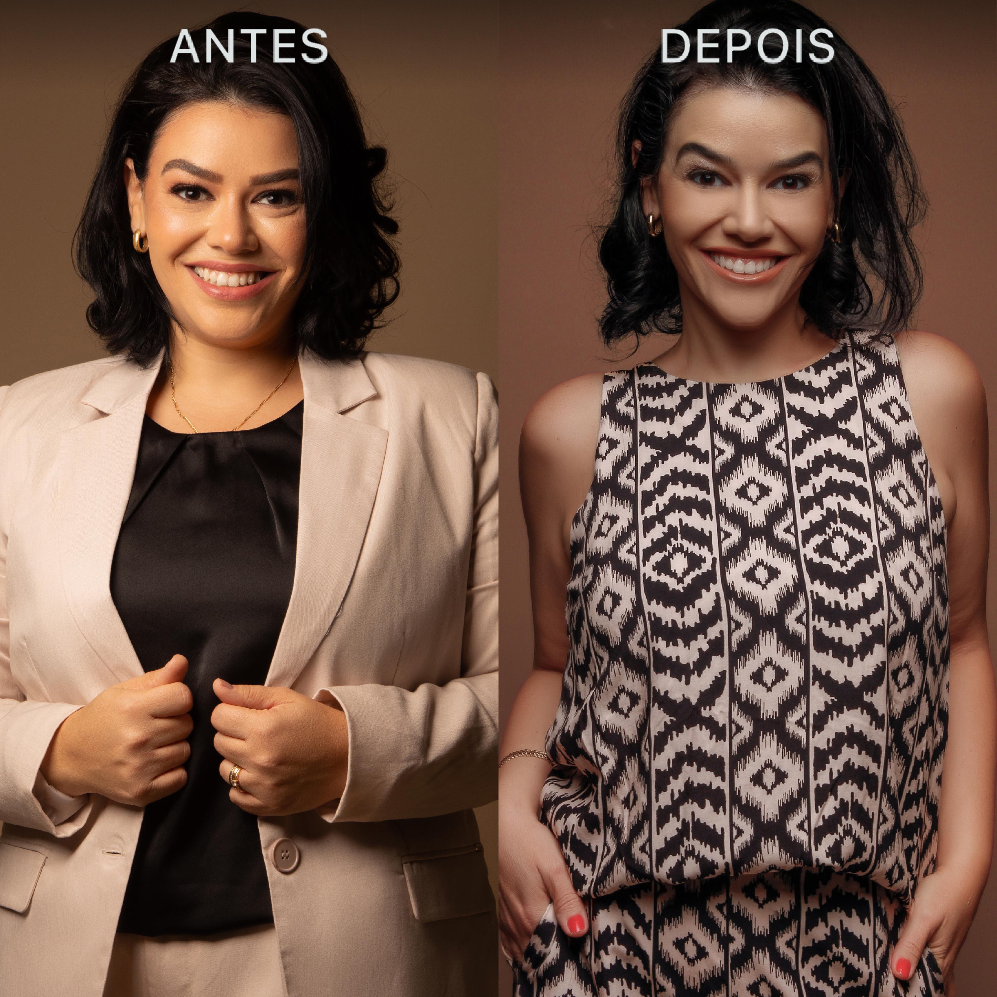 Antes e Depois Dra Lívia 19