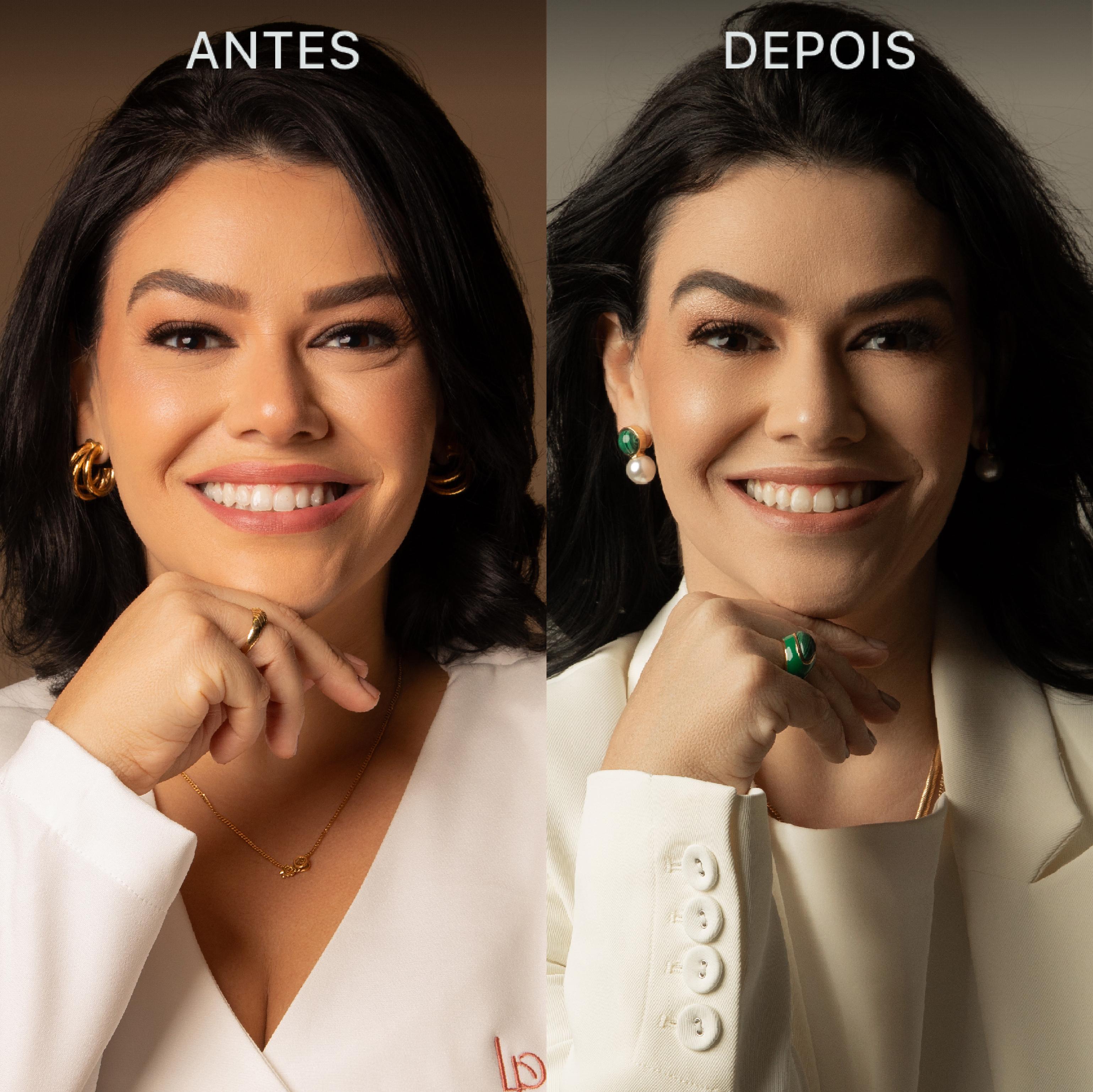 Antes e Depois Dra Lívia 23