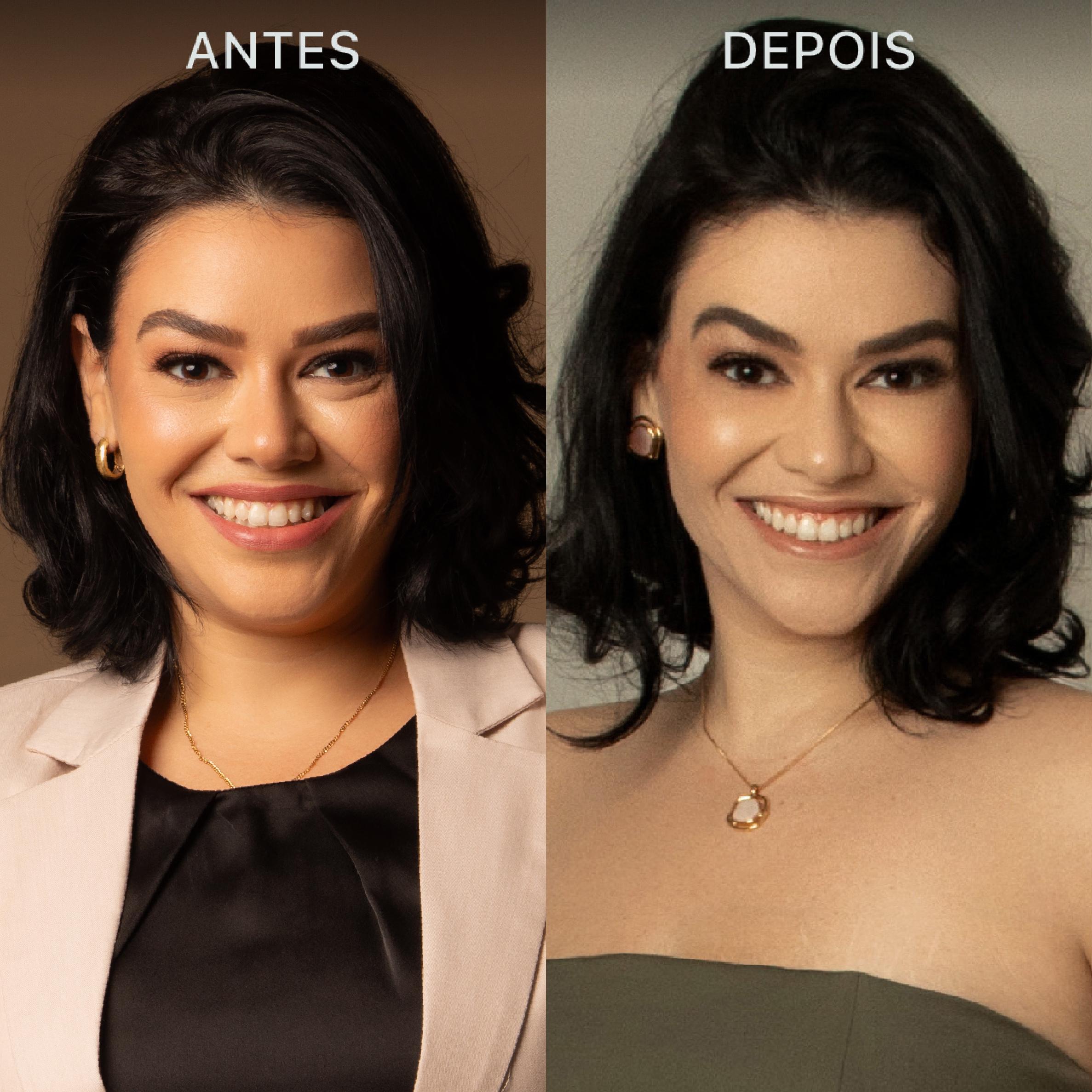 Antes e Depois Dra Lívia 24