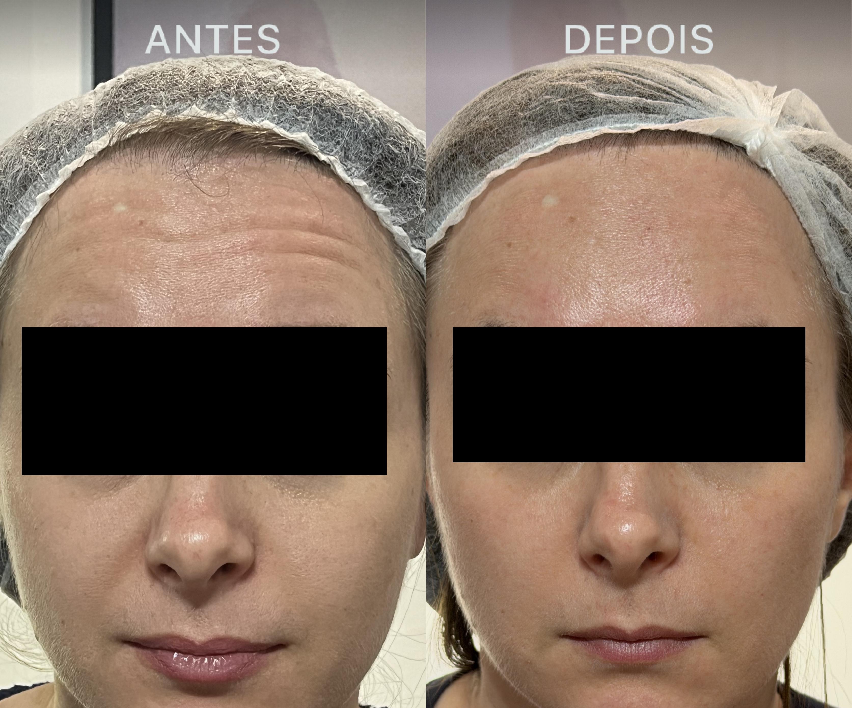 Antes e Depois Dra Lívia 26