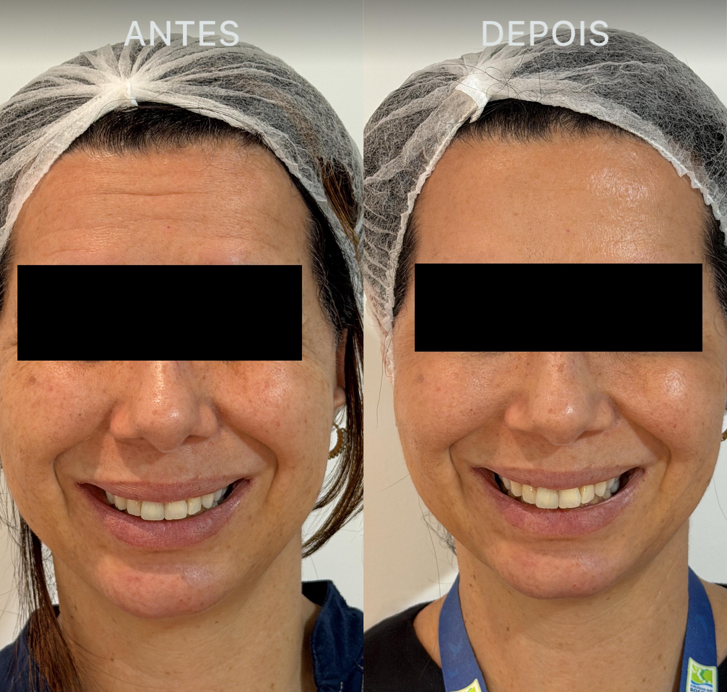 Antes e Depois Dra Lívia 27