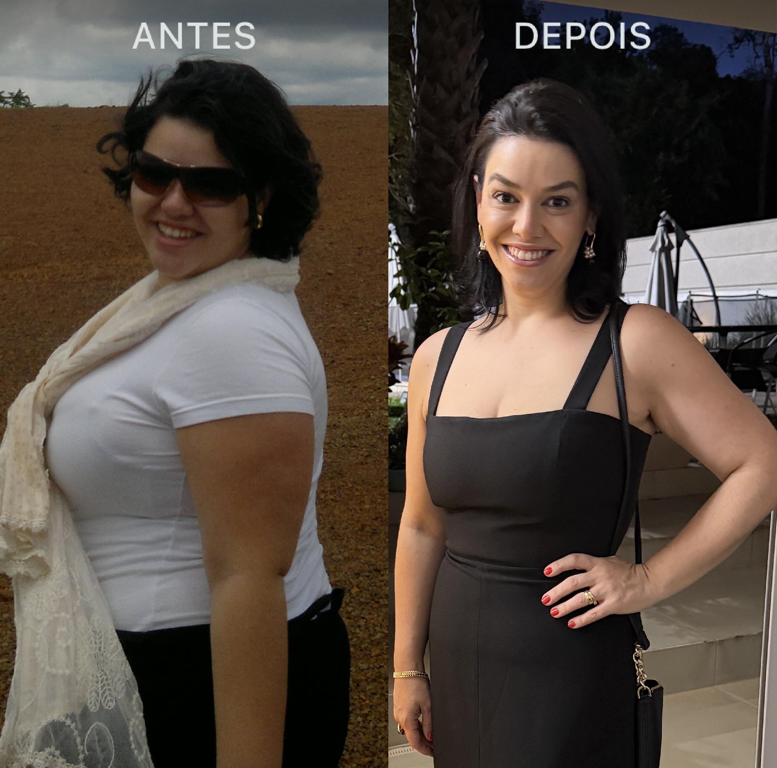 Antes e Depois Dra Lívia 1