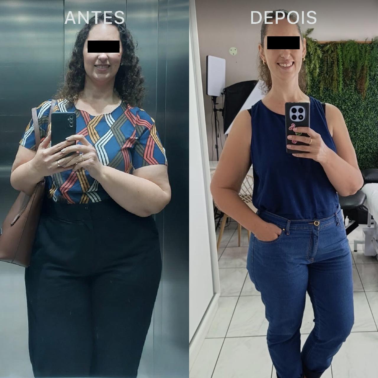 Antes e Depois Dra Lívia 2