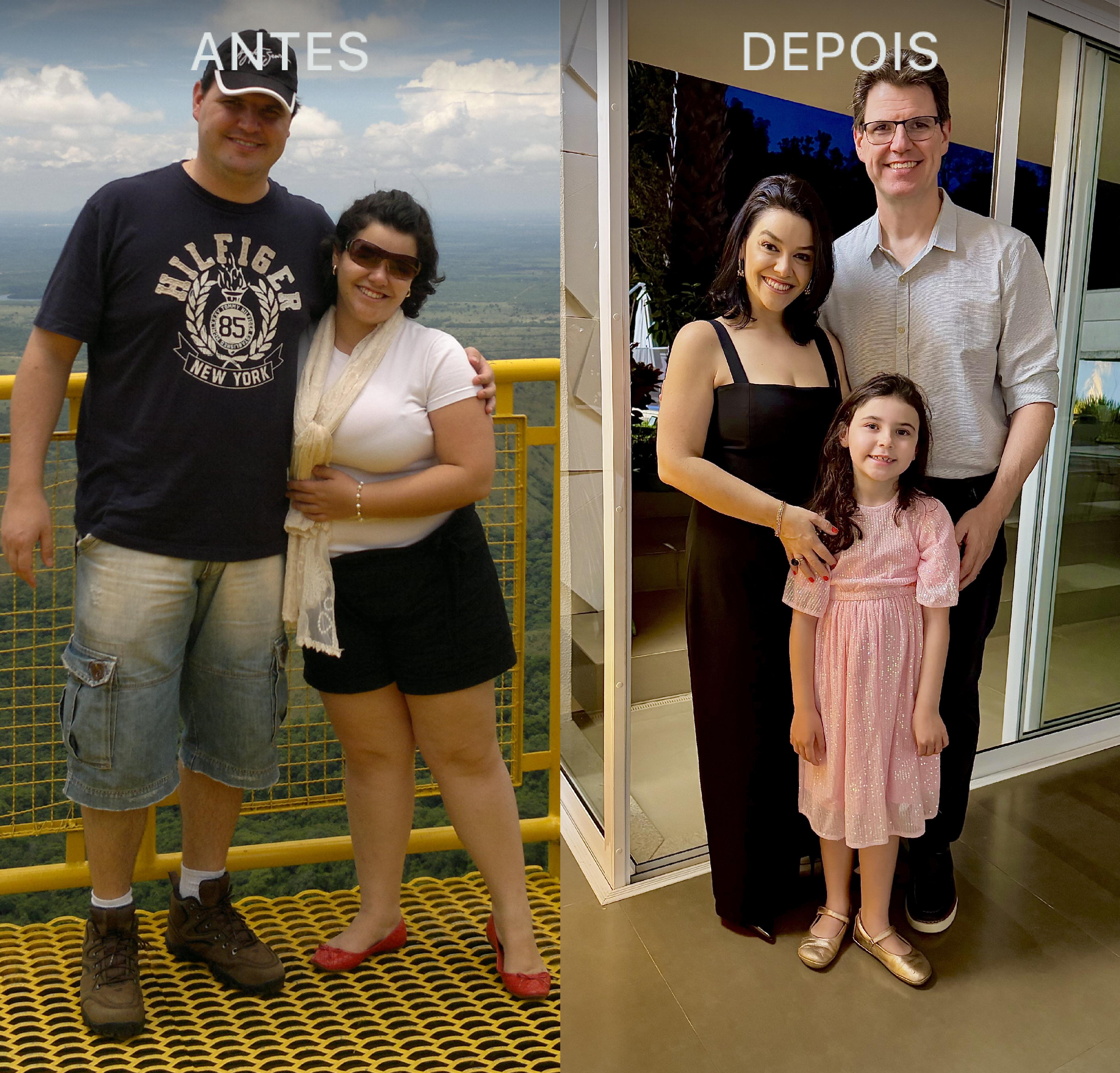 Antes e Depois Dra Lívia 6