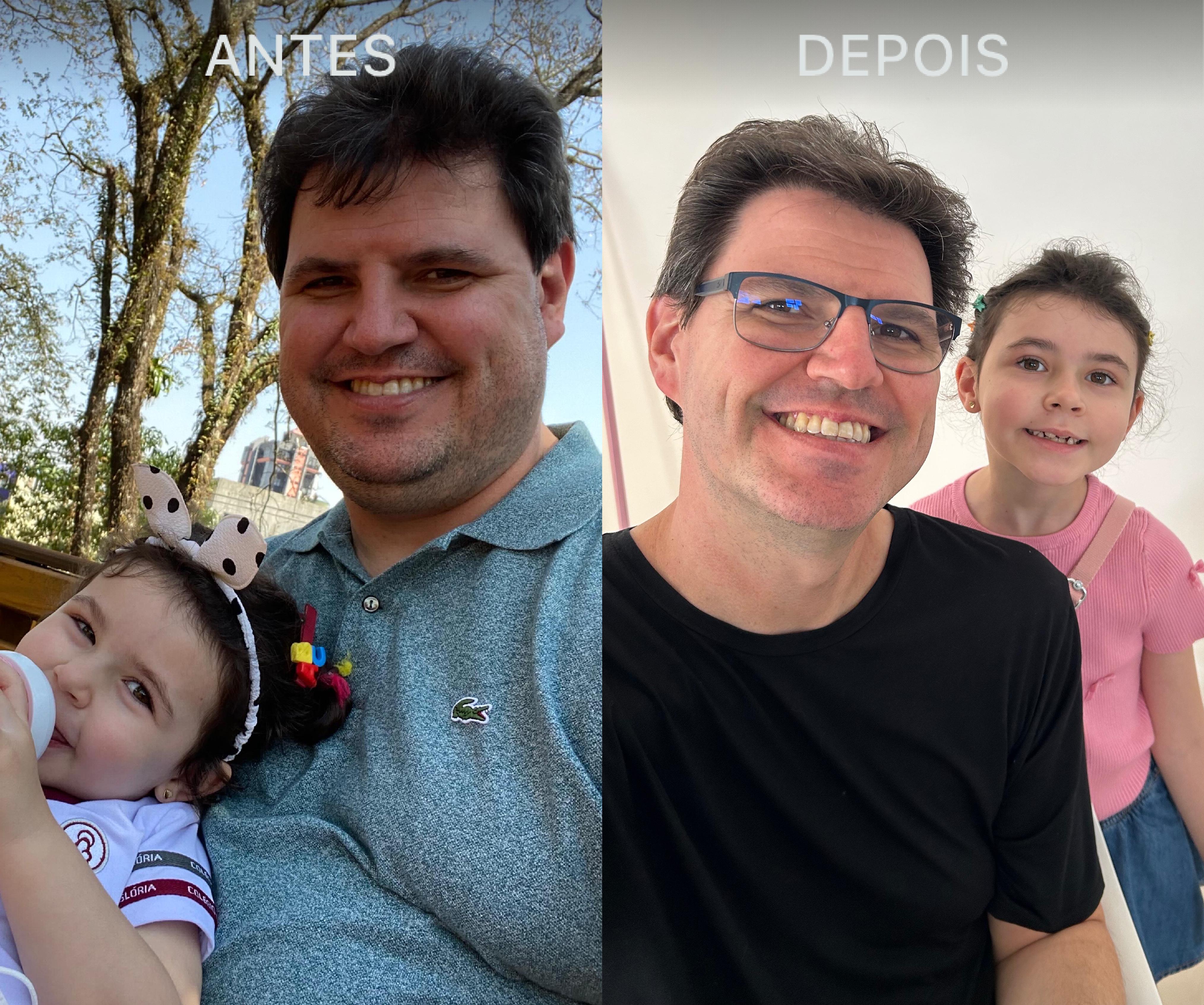 Antes e Depois Dra Lívia 8